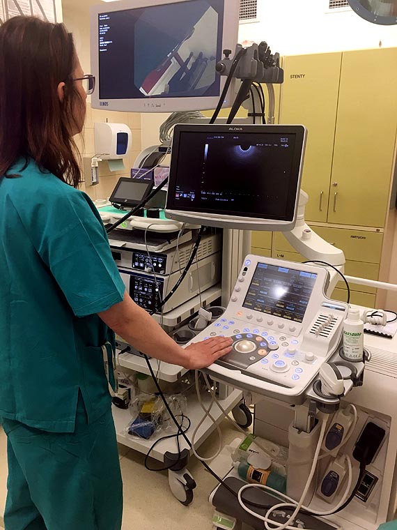 Szpital Wojewdzki w Szczecinie z nowym ultrasonografem endoskopowym. Jeszcze dokadniejsza diagnostyka przewodu pokarmowego